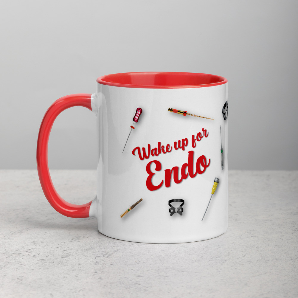 White Ceramic Mug with Color Inside