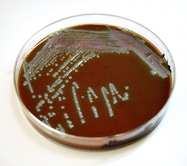 Take the Yeast-Fungus-Candida Quiz and See How You Measure Up